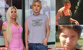 His birthday, what he did before fame, his family life, fun trivia facts, popularity rankings he was the subject of a german tv channel documentary called the beauty madness of oli london. Couple Spend Over 250k On Cosmetic Surgery To Look Like Idols Daily Mail Online