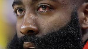 Los angeles lakers star lebron james is at a loss for words after seeing brooklyn nets guard james harden go down with another injury. Harden Still Dealing With Eye Injury Will Play In Game 3 Keye