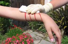 تفسير حلم الجروح تفسير رؤية الجرح في الحلم نهار الامارات