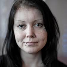 Stella, 25, tappade kontrollen över nätshoppingen: ”Alla pengar gick till  Klarna”