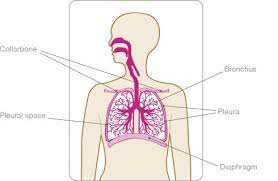 Cancer starts at a primary site in the body before spreading to other parts by way of the bloodstream distant the cancer has spread to more distant parts of the body, such as the bones, the liver, or the other lung. Secondary Breast Cancer In The Lung