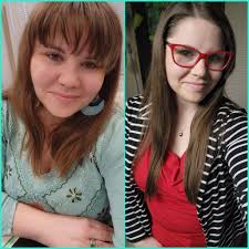 Does coconut oil help with dry scalp?