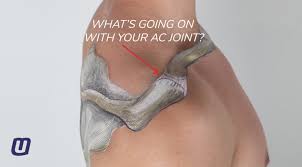 We did not find results for: The 3 Grades Of Ac Joint Separation And What They Mean Moveu