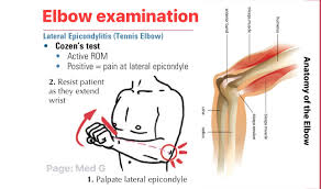 Image result for Elbow Exam