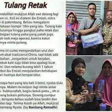 Kemudahan penggunaan akan selalu menjadi tujuan utama situs toko acep. Tulang Retak Agen Milagros Citraraya Tangerang Banten ÙÙŠØ³Ø¨ÙˆÙƒ