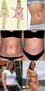 как похудеть быстро на 10 кг в домашних условиях Izbavlyaemsya Ot 6 Kg Vsego Za Nedelyu Populyarnaya Tajskaya Dieta Stala Moim Spaseniem Dieta Dieta Dlya Ploskogo Zhivota Bystro Pohudet