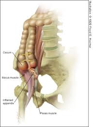 To find out the exact location of the appendix, you should do these steps: Acute Appendicitis Review And Update American Family Physician