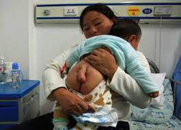 1歳半の赤ちゃんのペニスが成人サイズに異常発育！ 男児にも広がる中国「性早熟症」 (2016年1月27日) - エキサイトニュース