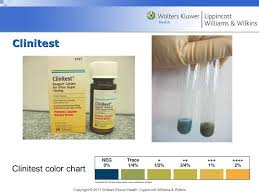Chapter 4 Chemical Analysis Of Urine Ppt Download