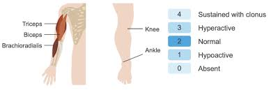 Image result for Reflex Exam