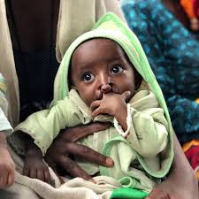 The surgical week is nearing its end. Our volunteers and partners completed  four surgeries today and will perform 2 surgeries Friday. Great work, team!  #changinglives #nonprofit #pediatricsurgery #ethiopia