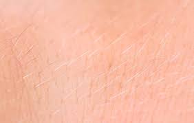 This type of hair loss presents almost exclusively in young men of african descent. 7 Reasons Your Body Hair Is Thinning Prevention