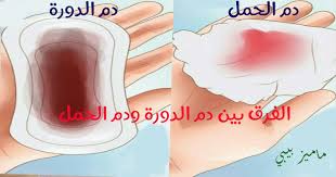 الفرق بين دم الدورة ودم الحمل الحمل والولادة ماميز بيبي