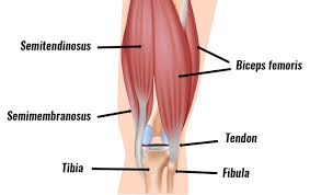 The long head of the biceps femoris is a weaker knee flexor when the hip is extended (because of active insufficiency). Hamstring Tendonitis Symptoms Causes Treatment Exercises