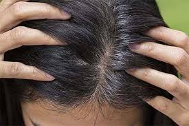 Scientists Think They Know How Stress Causes Grey Hair Health Dunya News
