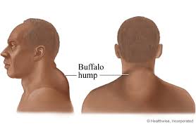 The right and left subclavian arteries give rise to the thyrocervical trunk. Buffalo Hump Imperial County California