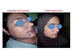 Dr. SK. Masud Hussain in Hutton Road,Asansol