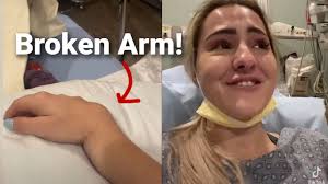 Broke my arm...BUT I'm back