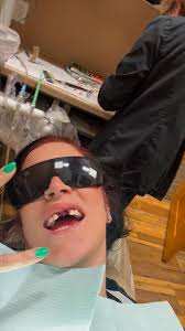 What are suggestions for bone grafts and implants after crowns are smashed?