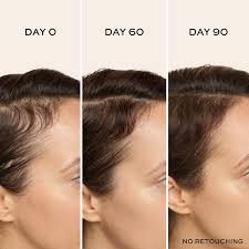 ULTRAfiller+ Hair Density Scalp Serum — For Fine Hair