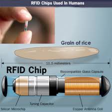 Rfid Chip Obamacare 300x300 Png 300 300 Microchip Implant Rfid Implants