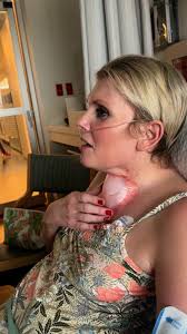 Beth and Whit's Recovery Progress