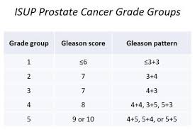 Image result for Prostate Cancer Histologic grading