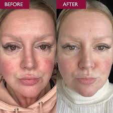 Skinician Brand Introduction by Aston &amp; Fincher