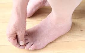 Picor En Los Pies Por Que Me Pican Como Puedo Evitarlo Podoactiva Lideres En Podologia