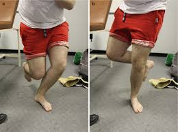 Image result for Thessaly Test