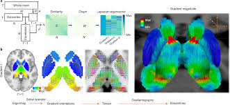 We did not find results for: Topographic Organization Of The Human Subcortex Unveiled With Functional Connectivity Gradients Nature Neuroscience