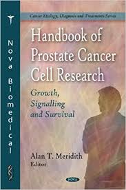2 in england and wales death rates have trebled over the last 30 years, one in 13 men is affected, and 20 000 cases are diagnosed each year. Handbook Of Prostate Cancer Cell Research Growth Signalling And Survival Cancer Etiology Diagnosis And Treatment 9781607419549 Medicine Health Science Books Amazon Com