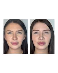 Andrea Gower (@andrea.injects) • Instagram photos and videos