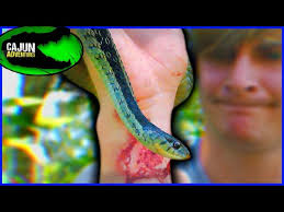 Image result for Snake Bite