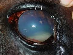 Image result for Hypopyon