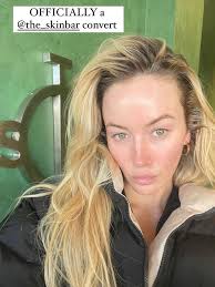 Skin needling: Samantha Appel opens fifth The Skin Bar clinic in Sydney