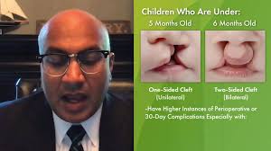 Safety of Cleft Lip Surgery for Preemies —Video Discussion Anand Raj Kumar,  MD