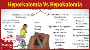 Hyperkalemia Vs Hypokalemia Easy To Remember Youtube