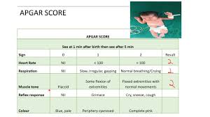 Image result for APGAR Score