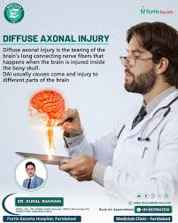 Image result for Diffuse Axonal Injury