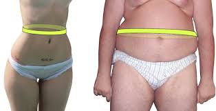 ما هي مواصفات الجسم المثالي. Ø®ØµØ± ÙˆÙŠÙƒÙŠØ¨ÙŠØ¯ÙŠØ§