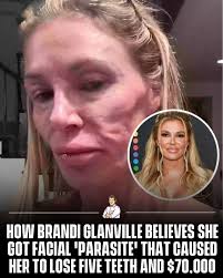 She quit smiling after a suspected parasite attack