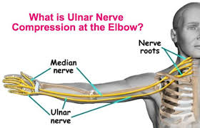 What Is Ulnar Nerve Compression At The Elbow Ulnar Nerve Ulnar Nerve Entrapment Median Nerve