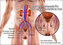 Home pediatric dentistry how long does teething last? Chlamydial Urethritis In Men Treatment Signs Symptoms Causes Complications Preventions