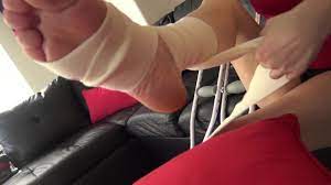 ROXIES ANKLE SPRAIN & HOPPING WITH CRUTCHES - Pornhub.com