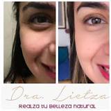 Cuántos años me quita el Botox? - Resultados antes y después ...