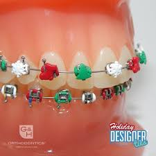 Designerties Orthodontics Braces Ligature Ties With Designs Orthodontics Orthodontics Braces Design