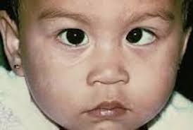 CHILDREN'S VISION MASSACHUSETTS