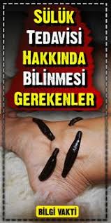 Suluk Tedavisi Hakkinda Bilinmesi Gerekenler Saglikli Yasam Tarzi Saglikli Yasam Saglik
