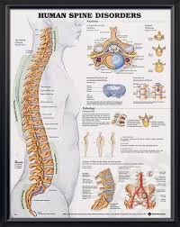 Human Spine Disorders Chart 20x26 Human Spine Spine